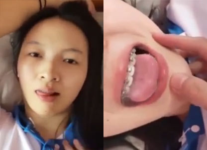 นักเรียนไทย น้องฟันเหล็ก อมควย ก่อนซอยหี น้ำแตกพ่นเต็มปาก